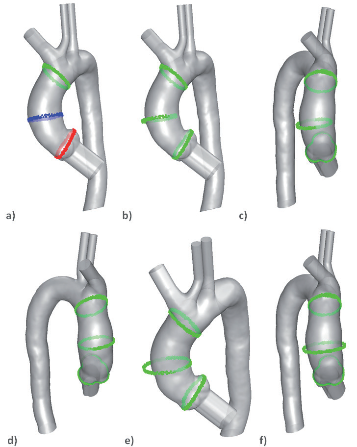 RBF set-up. Source points and their displacement
